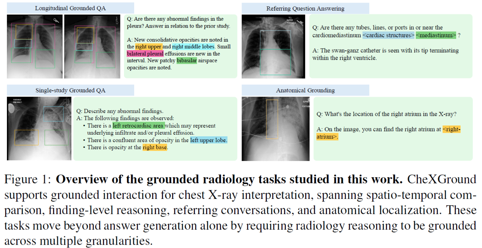 CheXGround grounded radiology tasks for longitudinal chest X-ray interpretation